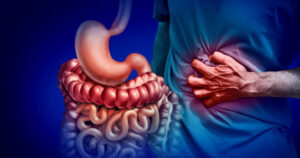 ulcerative colitis