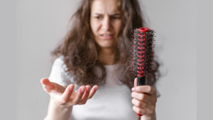 pcos and hair loss